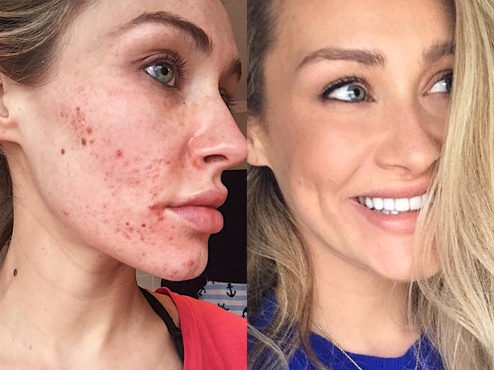 Tone-evening Brightening Plan