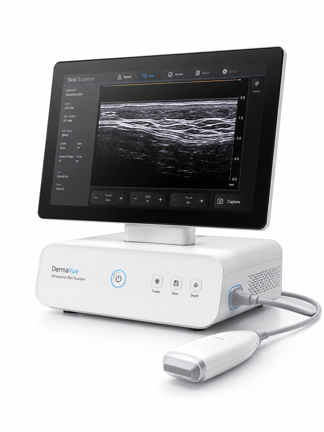 Ultrasound Skin Scanner