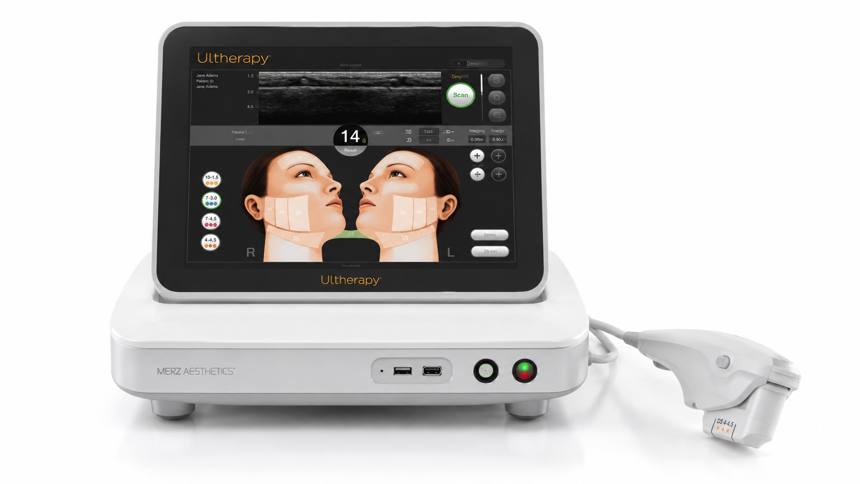 Ultherapy / HIFU treatment view