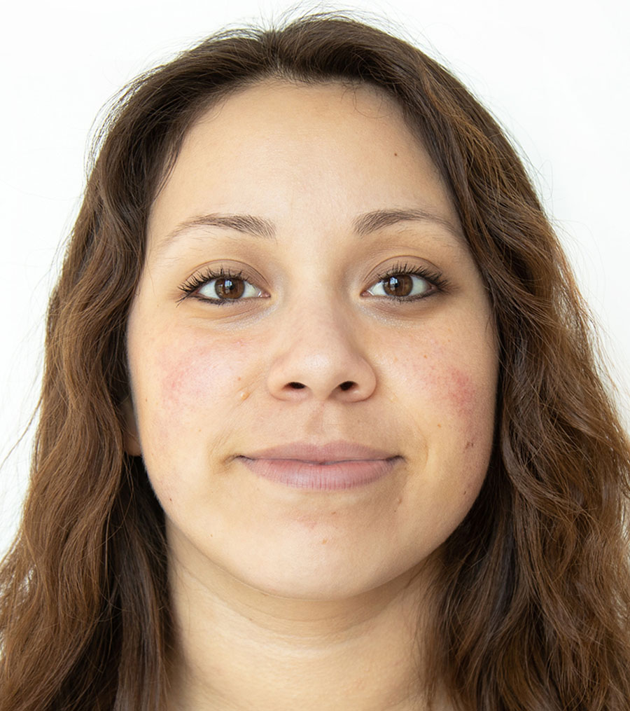 Before treatment result two